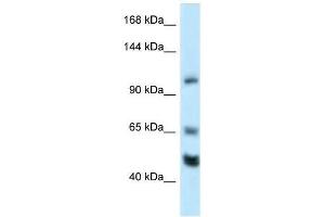 Western Blot showing Rest antibody used at a concentration of 1. (REST 抗体  (Middle Region))