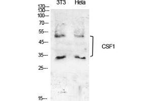 Western Blot analysis of NIH-3T3, hela cells using M-CSF Polyclonal Antibody. (M-CSF/CSF1 抗体  (C-Term))