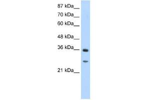 GIPC2 antibody used at 1. (GIPC2 抗体  (N-Term))