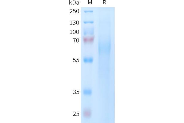 TIMD4 Protein (AA 25-314) (His tag)