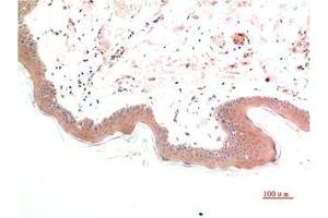 Immunohistochemical analysis of paraffin-embedded Human Skin Tissue using Phospho-Smad3(S425) Mouse mAb diluted at 1:200. (Phospho-SMAD3(S425) (pSer425) 抗体)