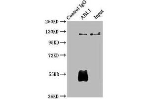 Immunoprecipitating ABL1 in Hela whole cell lysate Lane 1: Rabbit control IgG (1 μg) instead of ABIN7174001 in Hela whole cell lysate. (ABL1 抗体  (AA 4-194))