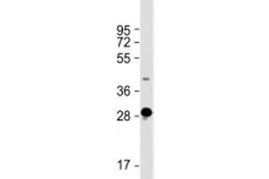 Western blot testing of human skeletal muscle lysate with DNASE1L2 antibody at 1:2000. (DNASE1L2 抗体  (AA 199-229))