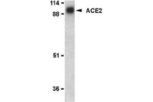 Image no. 2 for anti-Angiotensin I Converting Enzyme 2 (ACE2) (N-Term) antibody (ABIN319091) (ACE2 抗体  (N-Term))