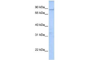 WDTC1 antibody used at 1 ug/ml to detect target protein. (WDTC1 抗体  (N-Term))