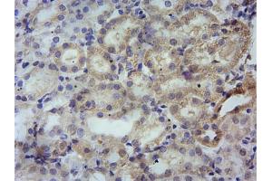 Immunohistochemistry (IHC) image for anti-Peripheral-Type Benzodiazepine Receptor (TSPO) (C-Term) antibody (ABIN570960)