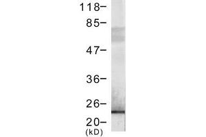 Image no. 1 for anti-DYKDDDDK Tag antibody (ABIN274245) (DYKDDDDK Tag 抗体)