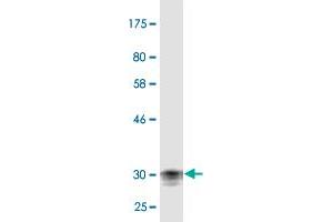 Western Blot detection against Immunogen (31. (Corneodesmosin 抗体  (AA 306-355))