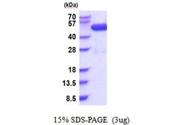 CSK Protein (AA 1-450) (His tag)