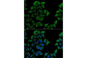 Immunofluorescence analysis of U2OS cells using TCN1 antibody (ABIN5973815). (TCN1 抗体)