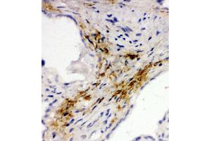 Immunohistochemistry (IHC) image for anti-Mucosal Vascular Addressin Cell Adhesion Molecule 1 (MADCAM1) (AA 173-190), (Middle Region) antibody (ABIN3044076)