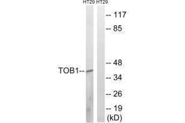 Protein Tob1 (TOB1) (Ser164) 抗体