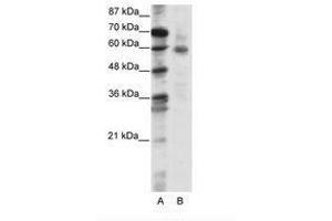 Image no. 1 for anti-Forkhead Box O1 (FOXO1) (N-Term) antibody (ABIN202855) (FOXO1 抗体  (N-Term))