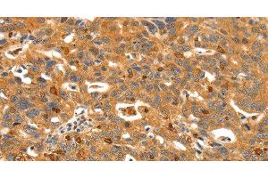 Immunohistochemistry (Paraffin-embedded Sections) (IHC (p)) image for anti-Somatostatin Receptor 3 (SSTR3) antibody (ABIN7242716)