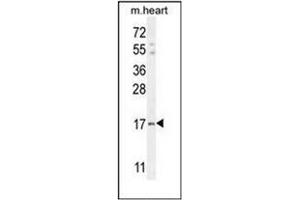 IER3 抗体  (N-Term)