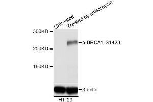 Western blot analysis of extracts of HT-29 cells,using Phospho-BRCA1-S1423 antibody (ABIN5969949) at 1/2000 dilution. (BRCA1 抗体  (pSer1423))