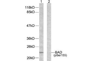 Western blot analysis of extracts from 293 cells using BAD (phospho-Ser155) antibody. (BAD 抗体  (pSer155))
