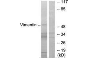 Western blot analysis of extracts from 293 cells, treated with EGF 200ng/ml 30', using Vimentin (Ab-83) Antibody. (Vimentin 抗体  (AA 56-105))