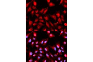 Immunofluorescence analysis of U2OS cells using DDX5 antibody. (DDX5 抗体)
