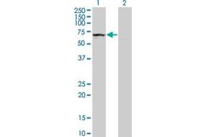 Western Blot analysis of KLHDC4 expression in transfected 293T cell line by KLHDC4 monoclonal antibody (M02), clone 4G11. (KLHDC4 抗体  (AA 1-463))