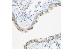 Immunohistochemistry of paraffin-embedded mouse lung using IGF2BP3 antibody. (IGF2BP3 抗体)