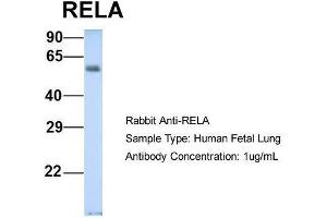 Host: Rabbit  Target Name: RELA  Sample Tissue: Human Fetal Lung  Antibody Dilution: 1. (NF-kB p65 抗体  (Middle Region))