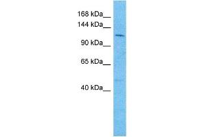 Host:  Rabbit  Target Name:  REST  Sample Type:  721_B Whole Cell lysates  Antibody Dilution:  1. (REST 抗体  (N-Term))