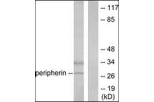 Western blot analysis of extracts from 293 cells, using PGP9. (UCHL1 抗体  (C-Term))