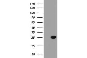 HEK293T cells were transfected with the pCMV6-ENTRY control (Left lane) or pCMV6-ENTRY C21orf56 (Right lane) cDNA for 48 hrs and lysed. (C21ORF56 抗体)