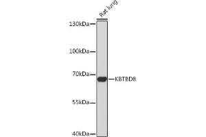 Western blot analysis of extracts of Rat lung, using KBTBD8 Rabbit pAb (ABIN7268076) at 1:1000 dilution. (KBTBD8 抗体)