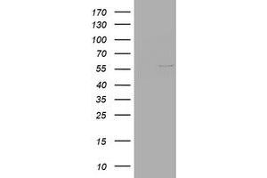 Image no. 1 for anti-Vimentin (VIM) (AA 210-466) antibody (ABIN1491202) (Vimentin 抗体  (AA 210-466))