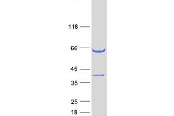 CCDC117 Protein (Myc-DYKDDDDK Tag)