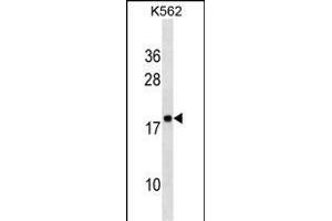 RPLP2 Antibody (N-Term) (ABIN653275 and ABIN2842791) western blot analysis in K562 cell line lysates (35 μg/lane). (RPLP2 抗体  (N-Term))