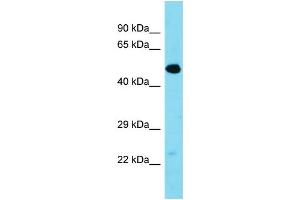 Western Blotting (WB) image for anti-Transmembrane Protein 39A (TMEM39A) (Middle Region) antibody (ABIN2500427) (TMEM39A 抗体  (Middle Region))