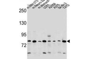 Western Blotting (WB) image for anti-Discoidin, CUB and LCCL Domain Containing 2 (DCBLD2) antibody (ABIN2997563) (DCBLD2 抗体)