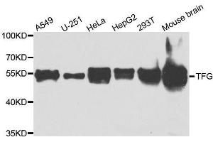 Western blot analysis of extracts of various cell lines, using TFG antibody. (TFG 抗体  (AA 1-240))