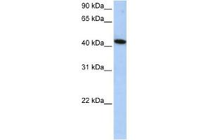 WB Suggested Anti-ICA1L Antibody Titration: 0. (ICA1L 抗体  (Middle Region))