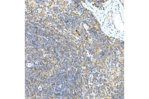 Immunohistochemistry of paraffin-embedded rat brain using LGR5/GPR49 Rabbit pAb  at dilution of 1:300 (40x lens). (LGR5 抗体  (AA 824-907))