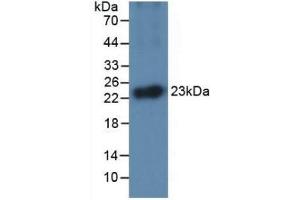 Detection of Recombinant IL1a, Equine using Monoclonal Antibody to Interleukin 1 Alpha (IL1a) (IL1A 抗体  (AA 95-269))