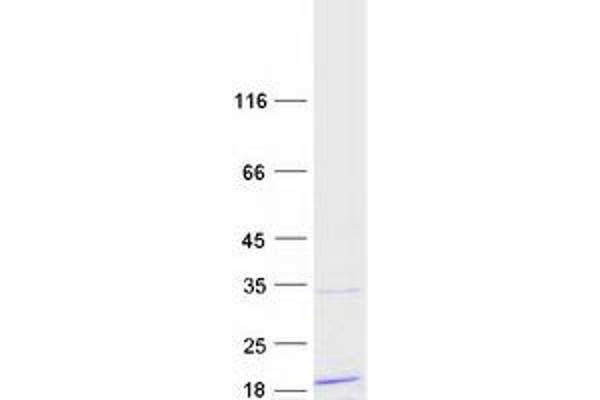 RPL14 Protein (Transcript Variant 2) (Myc-DYKDDDDK Tag)