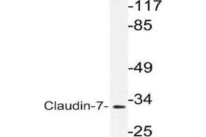 Western blot (WB) analysis of VDR antibody in extracts from rat liver cells. (Claudin 7 抗体)