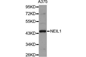 Western blot analysis of extracts of A375 cell line, using NEIL1 antibody. (NEIL1 抗体)
