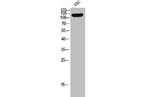 Western Blot analysis of VEC cells using Phospho-Tie-2 (Y992) Polyclonal Antibody (TEK 抗体  (pTyr992))