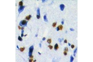 Immunohistochemical analysis of ZBTB48 staining in human brain formalin fixed paraffin embedded tissue section. (ZBTB48 抗体)