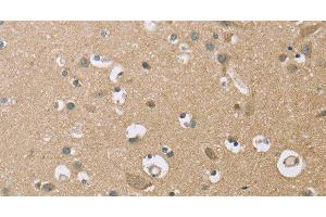 Immunohistochemistry of paraffin-embedded Human brain using ECHS1 Polyclonal Antibody at dilution of 1:35 (ECHS1 抗体)