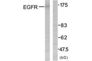 Western blot analysis of extracts from SK-OV3 cells, using EGFR (Ab-1070) Antibody. (EGFR 抗体  (AA 1041-1090))