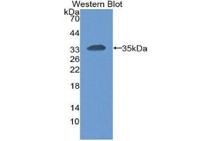Western Blotting (WB) image for anti-Carcinoembryonic Antigen-Related Cell Adhesion Molecule 1 (CEACAM1) (AA 35-320) antibody (ABIN3201732) (CEACAM1 抗体  (AA 35-320))