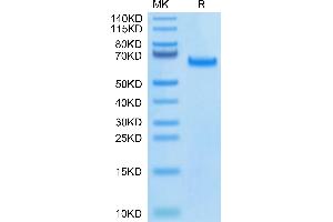 SDS-PAGE (SDS) image for delta-Like 4 (DLL4) (AA 27-524) protein (His-Avi Tag,Biotin) (ABIN7274487)