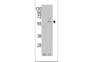 Western blot analysis of PMAT(Slc29a4) using rabbit polyclonal PMAT(Slc29a4) Antibody using 293 cell lysates (2 ug/lane) either nontransfected (Lane 1) or transiently transfected with the PMAT(Slc29a4) gene (Lane 2). (SLC29A4 抗体  (C-Term))