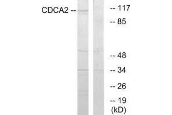 CDCA2 抗体  (C-Term)